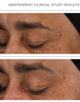 Synergie Skin Super Serum+ before and after eye area - visible fine line reduction anti-ageing serum Australia