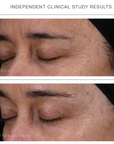 Synergie Skin Super Serum+ before and after skin texture - independent clinical study results anti-ageing Australia