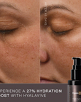 Synergie Skin HyalaVive before and after - 27% increase in hydration after 45 days hyaluronic serum Australia