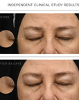 Synergie Skin Effica C before and after independent clinical study - vitamin C serum for pigmentation Australia