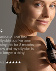 Synergie Skin Vitamin B 30ml customer review - niacinamide serum for oily skin buy online Australia