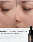 Synergie Skin Dermiotic before and after - 30 days to visibly stronger more resilient skin probiotic serum Australia
