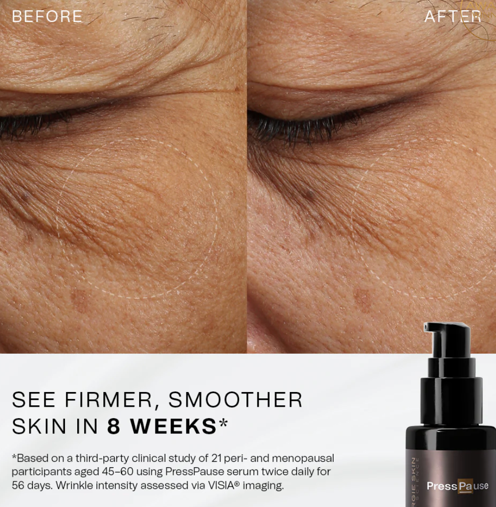 Synergie Skin Press Pause before and after - firmer smoother skin in 8 weeks for women over 40 Australia