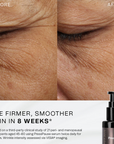 Synergie Skin Press Pause before and after - firmer smoother skin in 8 weeks for women over 40 Australia