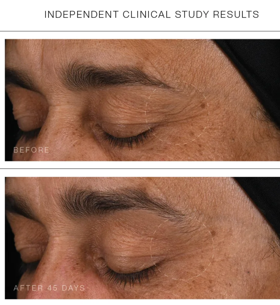 Synergie Skin Super Serum+ before and after eye area - visible fine line reduction anti-ageing serum Australia