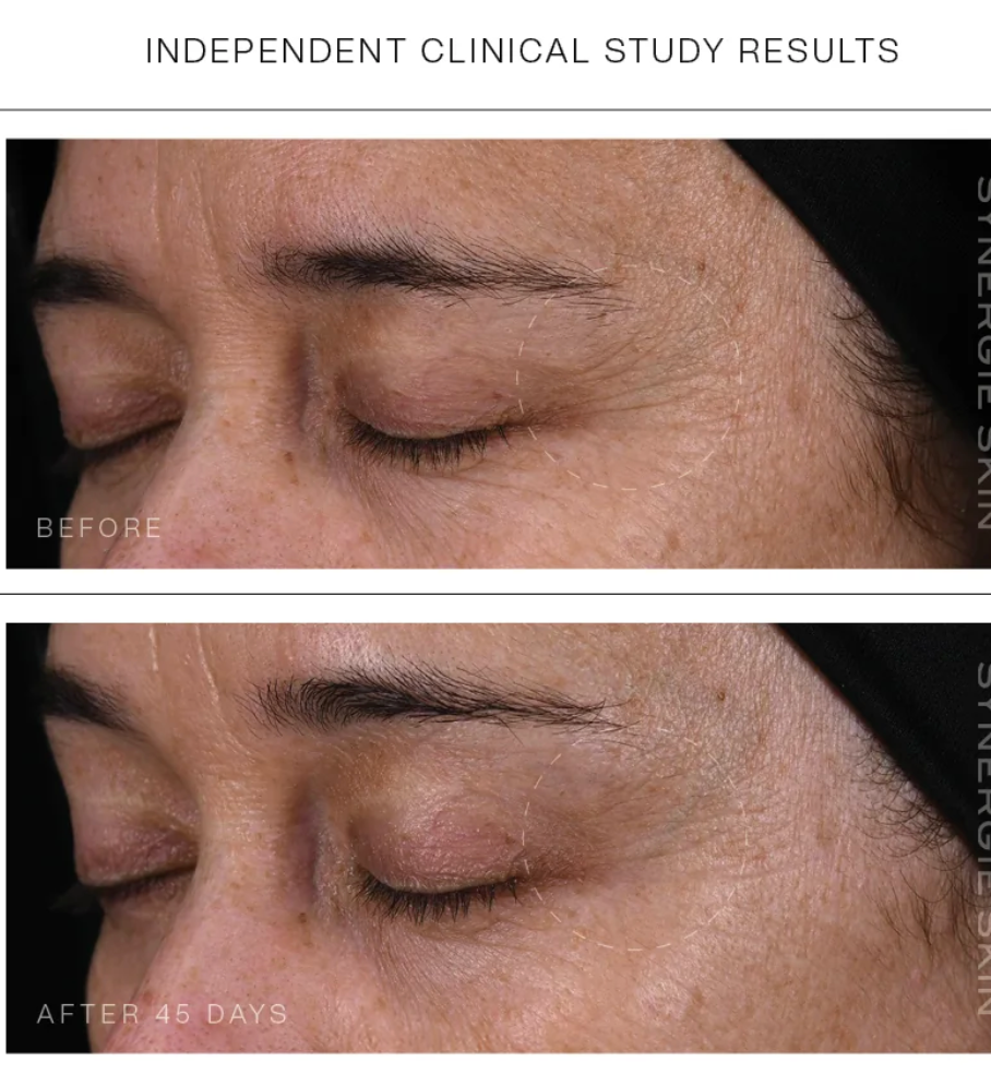 Synergie Skin Super Serum+ before and after skin texture - independent clinical study results anti-ageing Australia