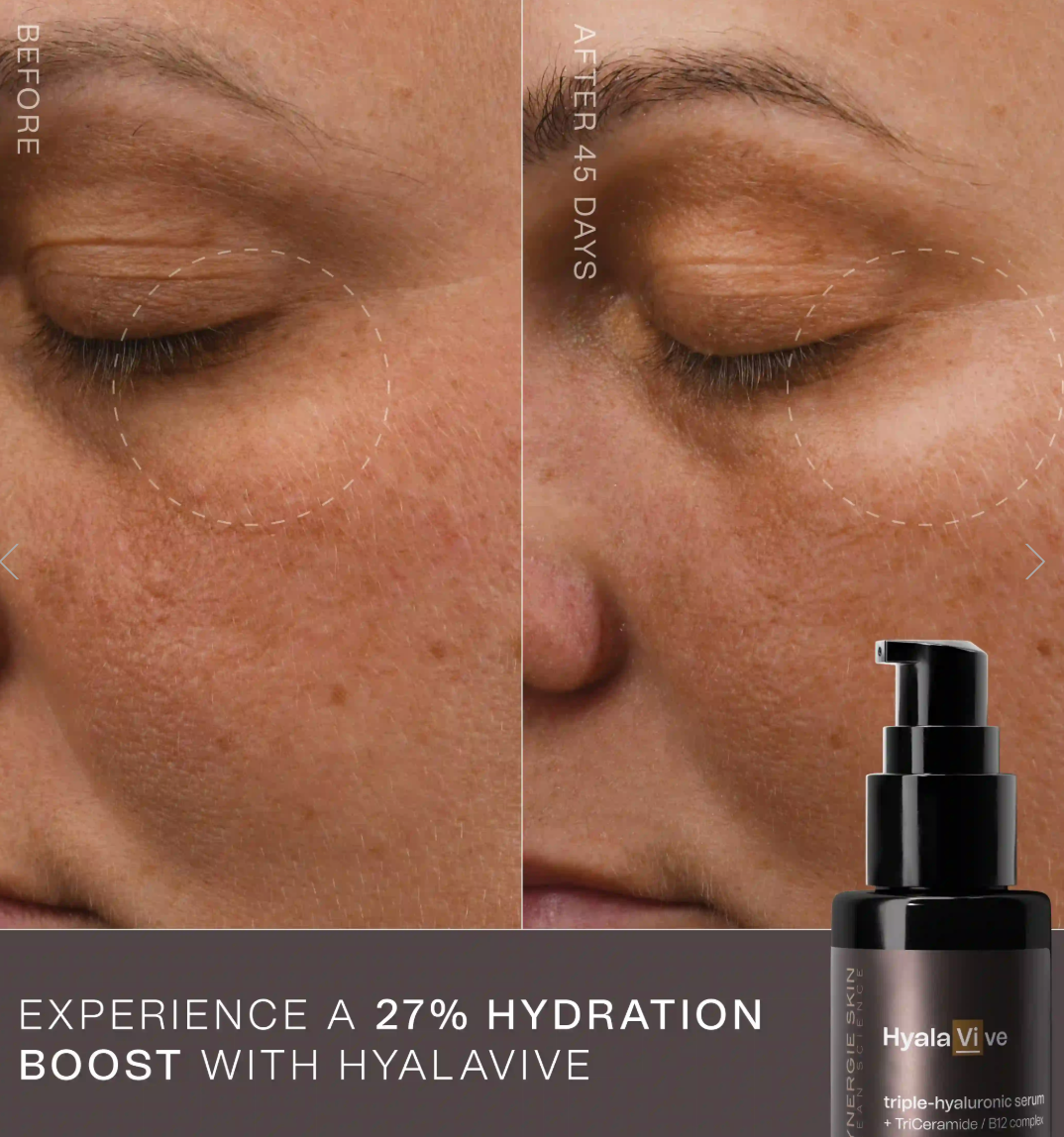 Synergie Skin HyalaVive before and after - 27% increase in hydration after 45 days hyaluronic serum Australia