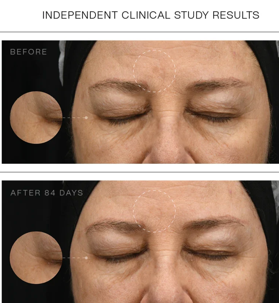 Synergie Skin Effica C before and after independent clinical study - vitamin C serum for pigmentation Australia
